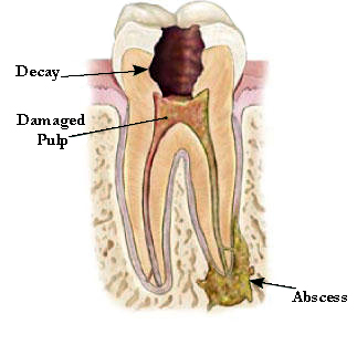 Why Choose an Endodontist | AK Endodontics | Dr. Anna Kim